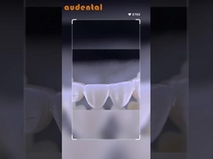 HT Beyaz 16 Sıvı Renkli Diş Zirkonya Bloku Karbon Kutusu Paketiyle