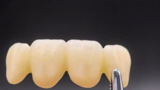 Audental 4D Master Zirkonya