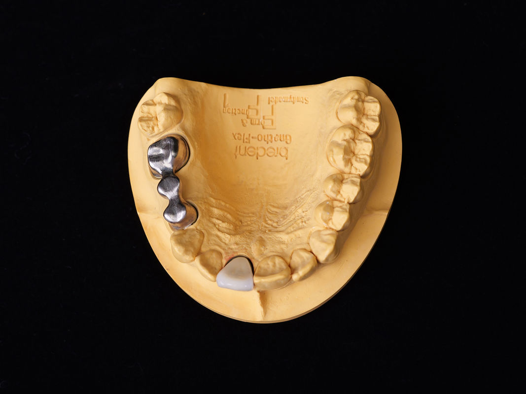 Audental 04 Noble Alloy Gümüş-Palladium Porselen Alloy Beyaz Pd53.3% Uzun Sürekli Diş Restorasyonları için