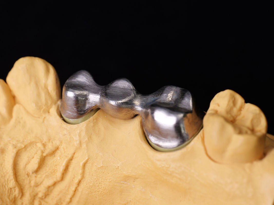 Audental 04 Noble Alloy Gümüş-Palladium Porselen Alloy Beyaz Pd53.3% Uzun Sürekli Diş Restorasyonları için