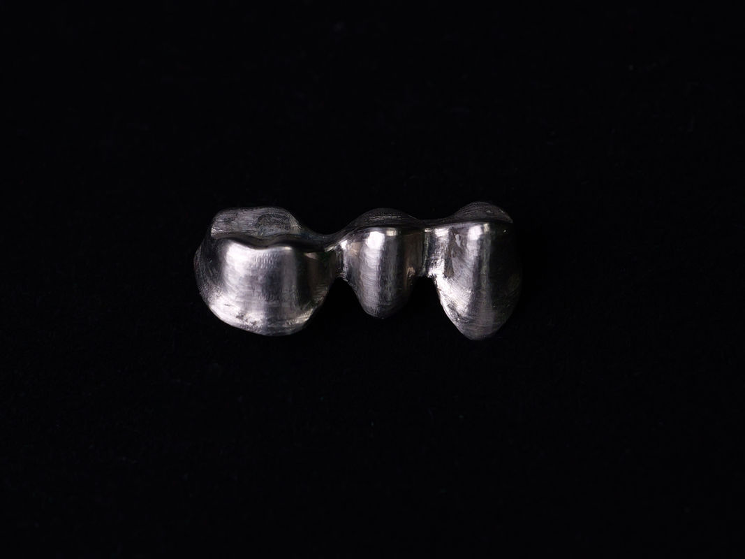 Audental 04 Noble Alloy Gümüş-Palladium Porselen Alloy Beyaz Pd53.3% Uzun Sürekli Diş Restorasyonları için